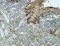 Clusterin Polyclonal Antibody